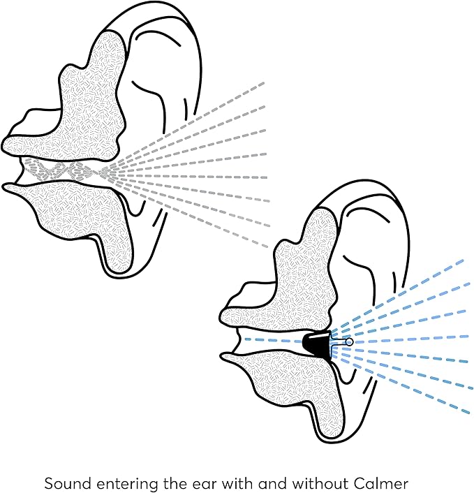Flare Audio Calmer - A Small in-Ear Device to Calm Sound sensitivities and Reduce Stress - for Sensitive Hearing, Misophonia, Noise Related Stress or Other Hearing Conditions…