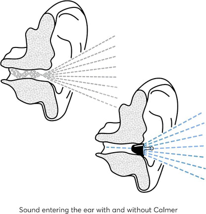Flare Audio Calmer - A Small in-Ear Device to Calm Sound sensitivities and Reduce Stress - for Sensitive Hearing, Misophonia, Noise Related Stress or Other Hearing Conditions…
